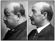 Jean Guillaume Auguste Lugol (18 August 1786 – 16 September 1851) 